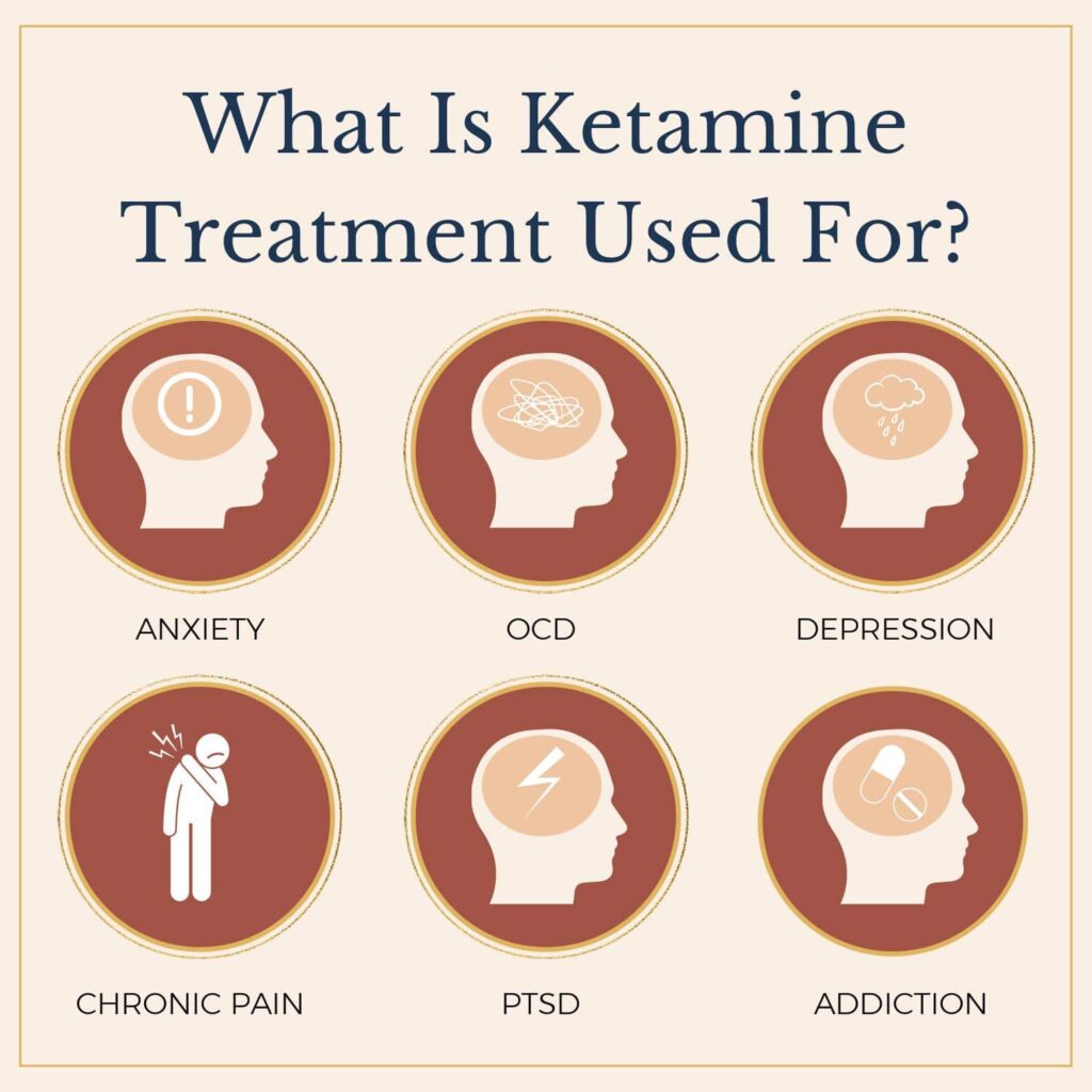An infographic titled "What Is Ketamine Therapy Used For?" displays six circular icons with text and images: Anxiety, OCD, Depression, Chronic Pain, PTSD, and Addiction. Each icon depicts a corresponding symbolic representation for each condition. Ideal for 2024 marketing strategies. - Ketamine
